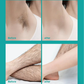 🔥Creme de depilação indolor para todo o corpo, para homens e mulheres – Suave para a pele em todas as zonas🌿